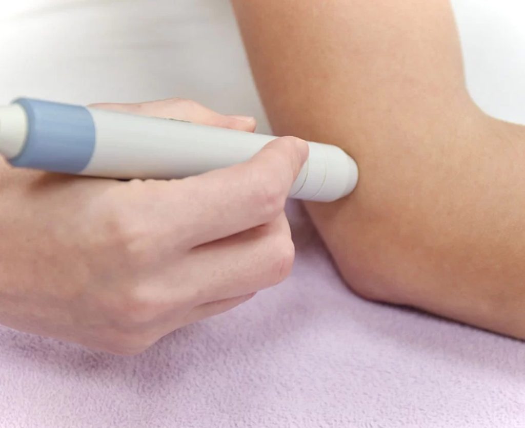 Fizikalna terapija laserom