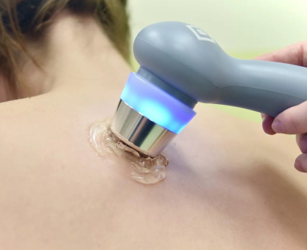 fizikalna terapija ultrazvuk